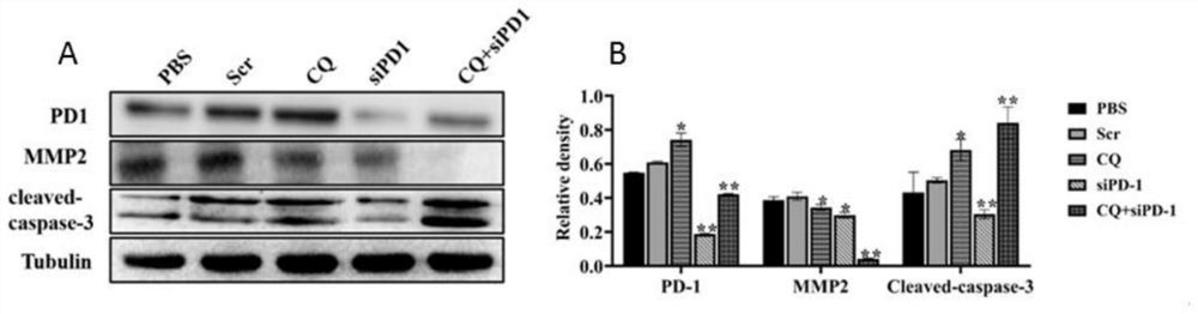 PD-1siRNA聯(lián)合氯喹在制備治療直腸癌藥物中的應(yīng)用