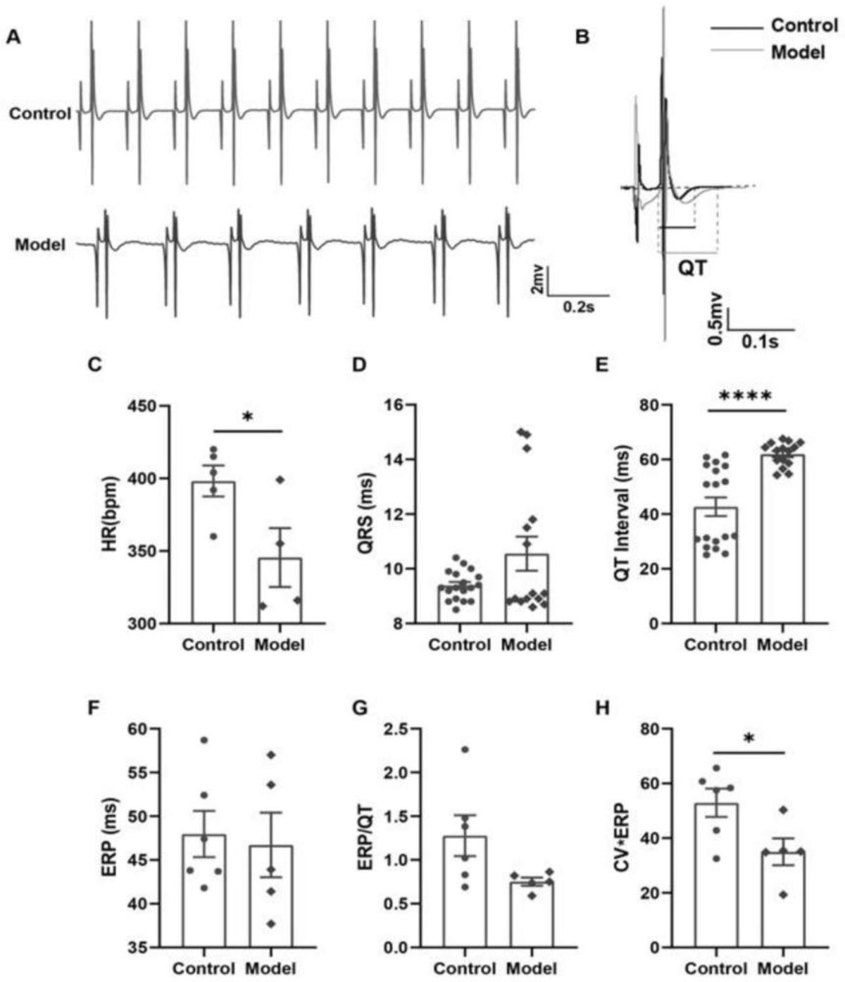 一種PGC-1α基因敲除小鼠構(gòu)建心律失常動物模型的方法及其應(yīng)用