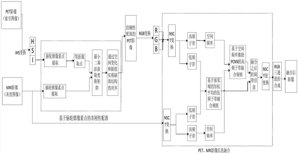 一種改進神經網絡的PET/MRI異機腦部影像信息融合方法